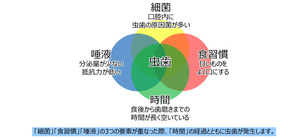 虫歯の発生要因