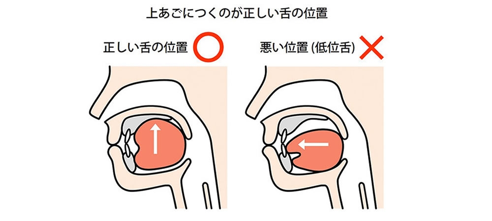 正しい舌の位置