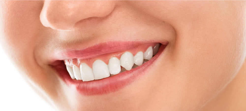 健康的な白い歯